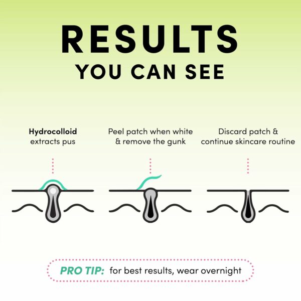 716Th3D2hnL_SL1500_jpg - Compare and Shop The Best Products NOW